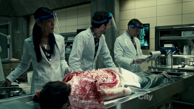 본격침샘어택미드 한니발(Hannibal) 시즌1 에피5 (2/4) *시체주의* | 인스티즈